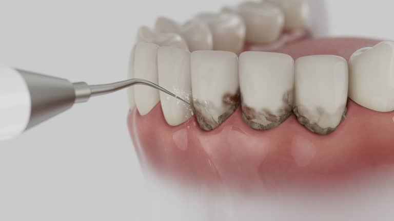 Reliable Teeth Cleaning And Checkup contractor in Ingham County County, MI by Dentist Open Now